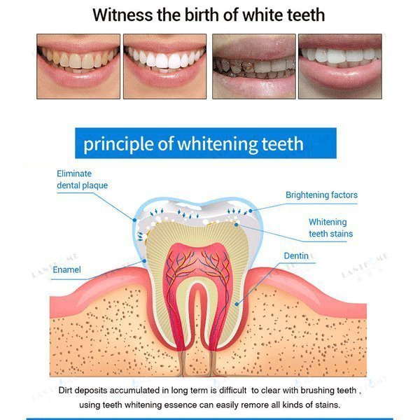 teeth whitening pensw2ast