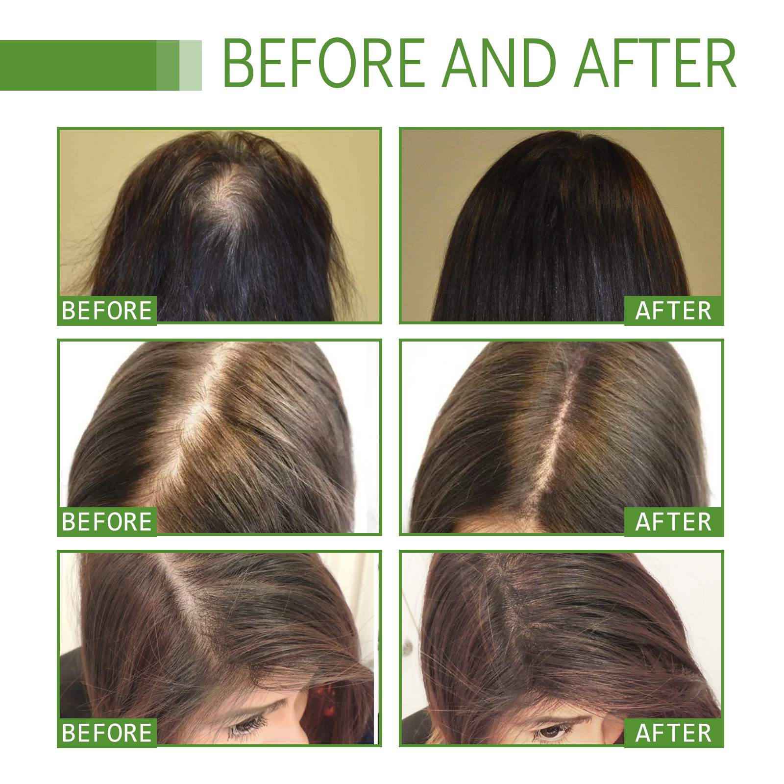 shelure hair regrowth treatment advanced k3teh